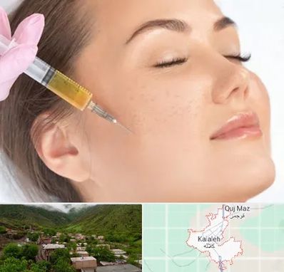 آموزش تزریق ژل و بوتاکس در کلاله
