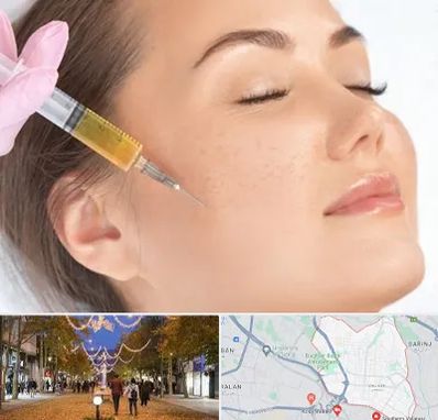 آموزش تزریق ژل و بوتاکس در ولیعصر ارومیه