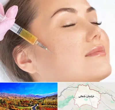 آموزش تزریق ژل و بوتاکس در خراسان شمالی