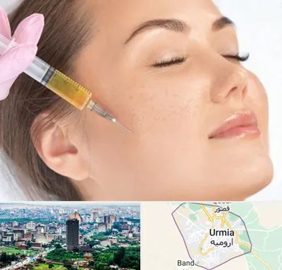 آموزش تزریق ژل و بوتاکس در ارومیه