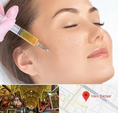 آموزش تزریق ژل و بوتاکس در بازار وکیل شیراز