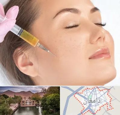 آموزش تزریق ژل و بوتاکس در دامغان