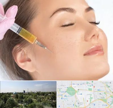 آموزش تزریق ژل و بوتاکس در منطقه 16 تهران 