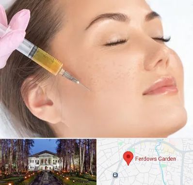 آموزش تزریق ژل و بوتاکس در باغ فردوس