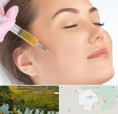 آموزش تزریق ژل و بوتاکس در بهبهان