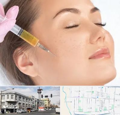 آموزش تزریق ژل و بوتاکس در 17شهریور