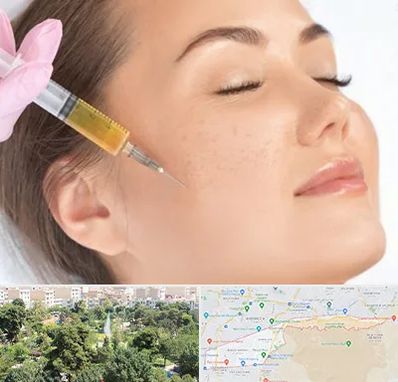 آموزش تزریق ژل و بوتاکس در منطقه 13 تهران