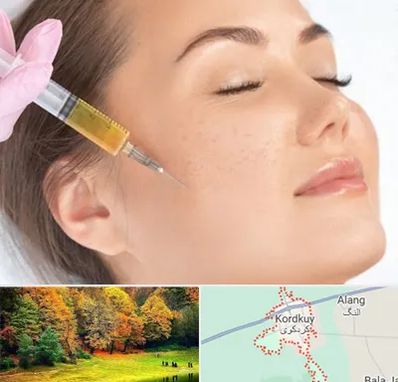 آموزش تزریق ژل و بوتاکس در کردکوی