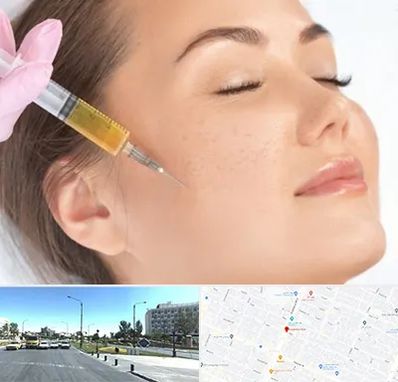 آموزش تزریق ژل و بوتاکس در بلوار کلاهدوز مشهد 