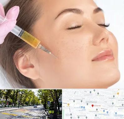 آموزش تزریق ژل و بوتاکس در میرداماد 