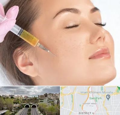 آموزش تزریق ژل و بوتاکس در یوسف آباد 