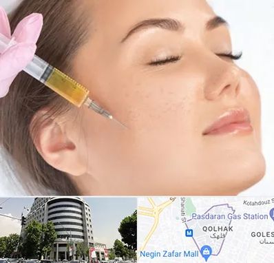 آموزش تزریق ژل و بوتاکس در قلهک 