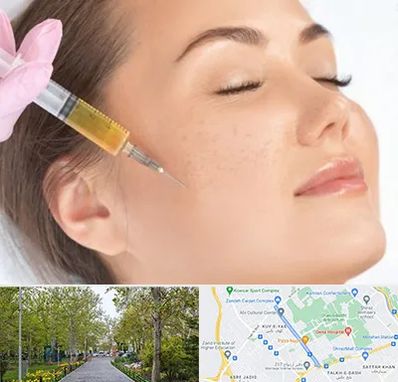 آموزش تزریق ژل و بوتاکس در قدوسی غربی شیراز 