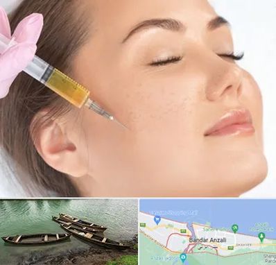 آموزش تزریق ژل و بوتاکس در بندر انزلی