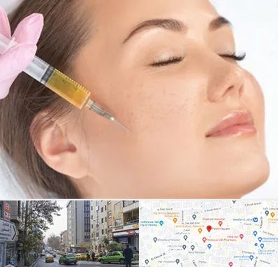 آموزش تزریق ژل و بوتاکس در فاطمی 