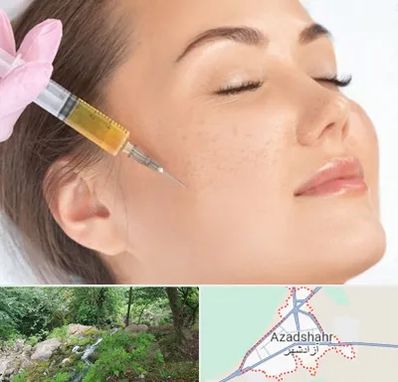 آموزش تزریق ژل و بوتاکس در آزادشهر
