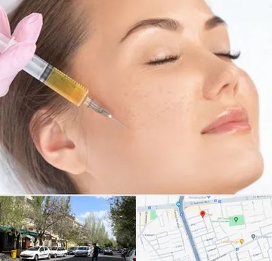 آموزش تزریق ژل و بوتاکس در کوی فیروز تبریز