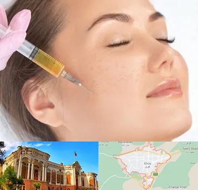 آموزش تزریق ژل و بوتاکس در خوی