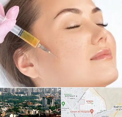 آموزش تزریق ژل و بوتاکس در عظیمیه کرج 