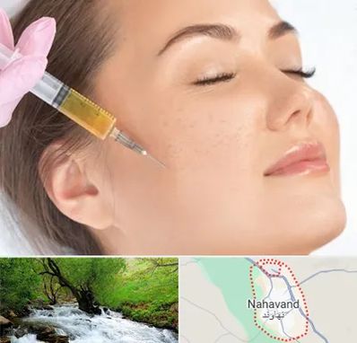آموزش تزریق ژل و بوتاکس در نهاوند