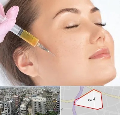 آموزش تزریق ژل و بوتاکس در آذری