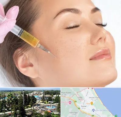 آموزش تزریق ژل و بوتاکس در رودسر