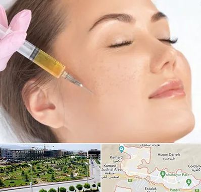 آموزش تزریق ژل و بوتاکس در پردیس