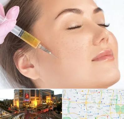 آموزش تزریق ژل و بوتاکس در جنت آباد تهران 