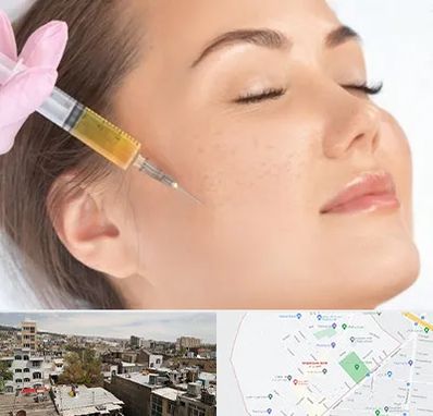 آموزش تزریق ژل و بوتاکس در شمیران نو 