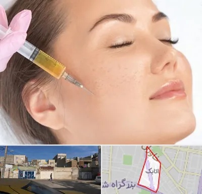 آموزش تزریق ژل و بوتاکس در اتابک