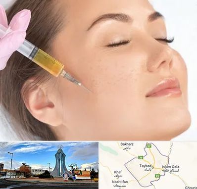 آموزش تزریق ژل و بوتاکس در تایباد