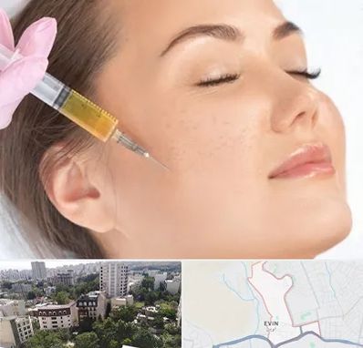 آموزش تزریق ژل و بوتاکس در اوین