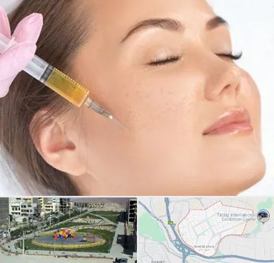 آموزش تزریق ژل و بوتاکس در مرزداران تبریز