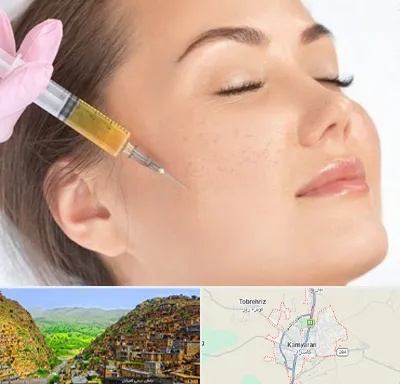آموزش تزریق ژل و بوتاکس در کامیاران