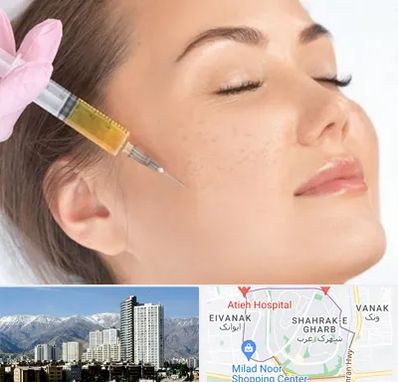 آموزش تزریق ژل و بوتاکس در شهرک غرب