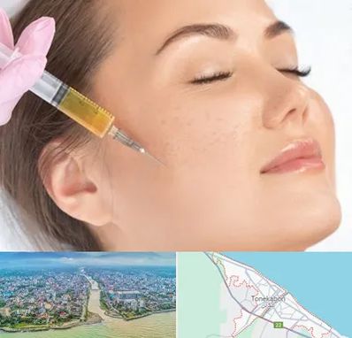 آموزش تزریق ژل و بوتاکس در تنکابن