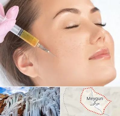 آموزش تزریق ژل و بوتاکس در میگون