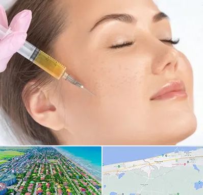 آموزش تزریق ژل و بوتاکس در فریدونکنار