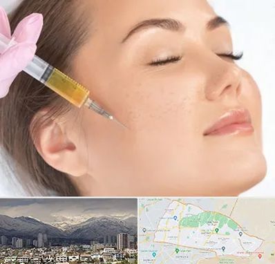 آموزش تزریق ژل و بوتاکس در منطقه 4 تهران 