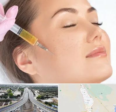 آموزش تزریق ژل و بوتاکس در اندیمشک