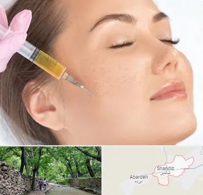 آموزش تزریق ژل و بوتاکس در شاندیز مشهد