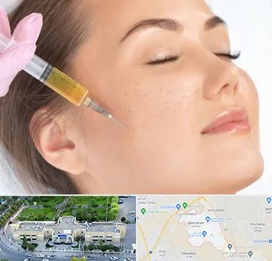 آموزش تزریق ژل و بوتاکس در نسیم شهر