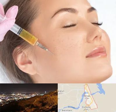 آموزش تزریق ژل و بوتاکس در میناب