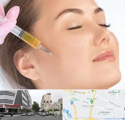 آموزش تزریق ژل و بوتاکس در بلوار فردوس 