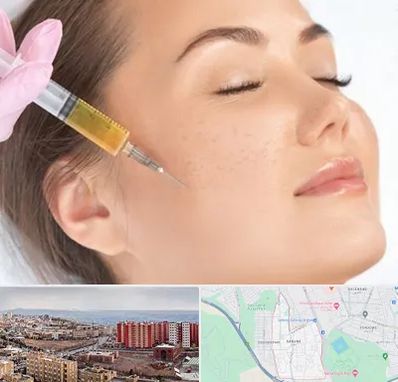 آموزش تزریق ژل و بوتاکس در سهند تبریز