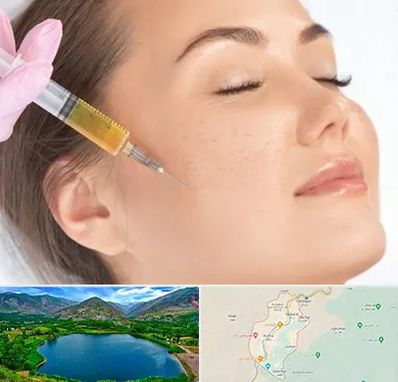 آموزش تزریق ژل و بوتاکس در رودبار