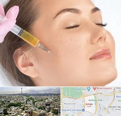 آموزش تزریق ژل و بوتاکس در گیشا 