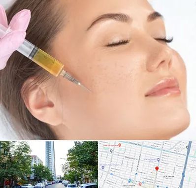 آموزش تزریق ژل و بوتاکس در امامت مشهد 