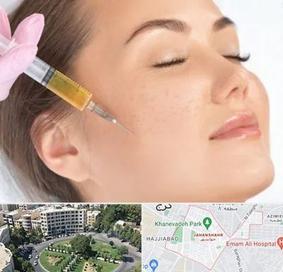 آموزش تزریق ژل و بوتاکس در جهانشهر کرج 