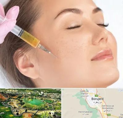 آموزش تزریق ژل و بوتاکس در بروجرد